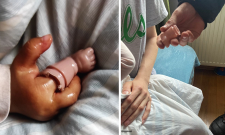 На Прикарпатті в однорічна дівчинка не могла витягти палець з іграшки | На допомогу приїхали рятувальники