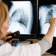 На Долинщині виявили 20 нових випадків туберкульозу серед людей